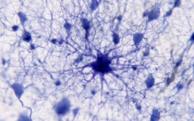 Astrocytes: What Are They and What Do They Do?