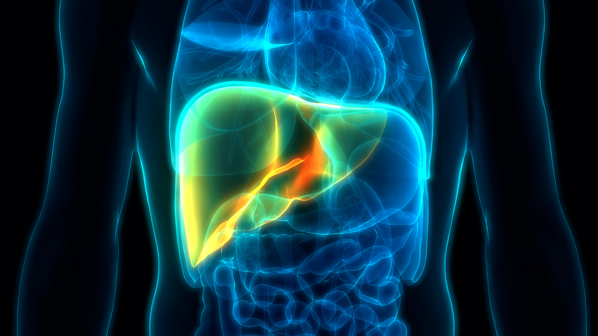 NASH disease models for developing new treatments.