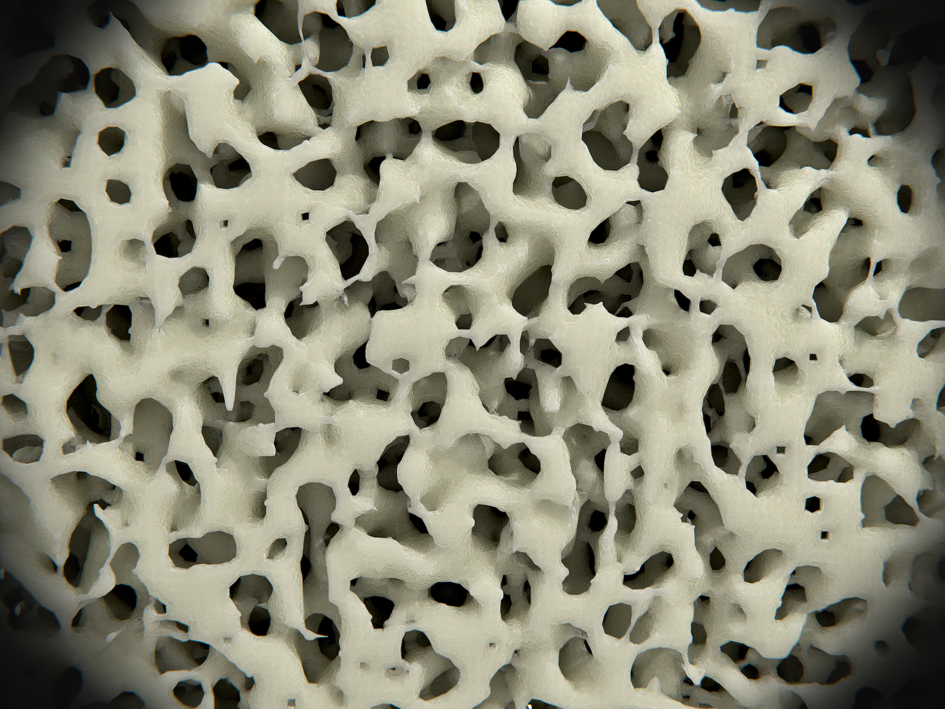 bone cells under microscope