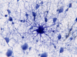 Human astrocytes, a type of glial cell and an important part of the central nervous system.