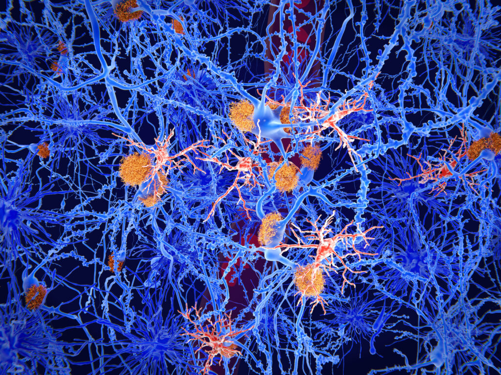 Microglia: Key Cells To Understanding Alzheimer's Disease - Tempo ...